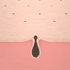 Электрический очиститель угрей Xiaomi Wellskins Electric Blackhead Cleaner (WX-HT100)